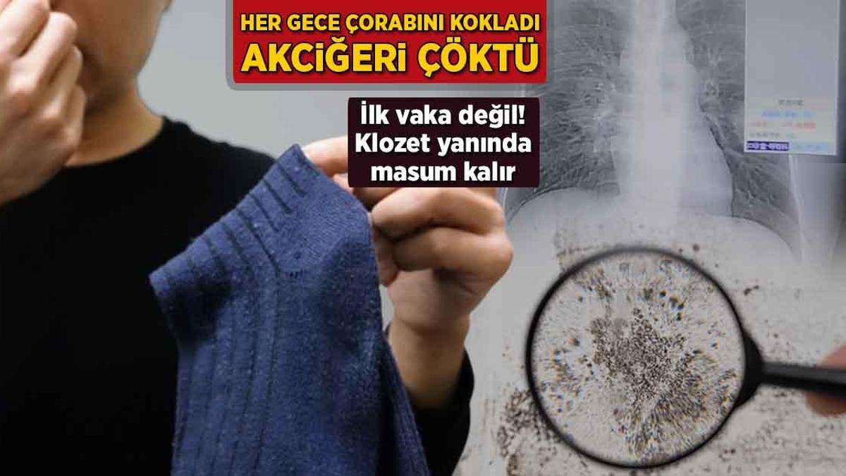 Her gece çorabını kokladı, akciğeri çöktü! İlk vaka değil: ‘Klozet yanında masum kalır’